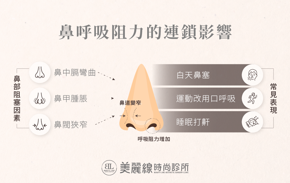 鼻中膈彎曲與白天鼻塞、運動時嘴巴呼吸及夜間打鼾的關聯示意圖
